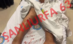 Şanlıurfa'da Korku Dolu Anlar! Küçük Çocuk Köpeklerin Hedefi Oldu
