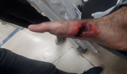 Yılan yerine ayağına sıktı