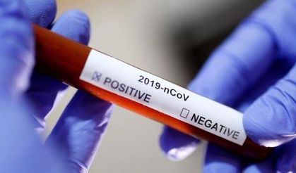 Şanlıurfa'da 5 yerden karantina kalktı 7 yeni yerde ise başladı.