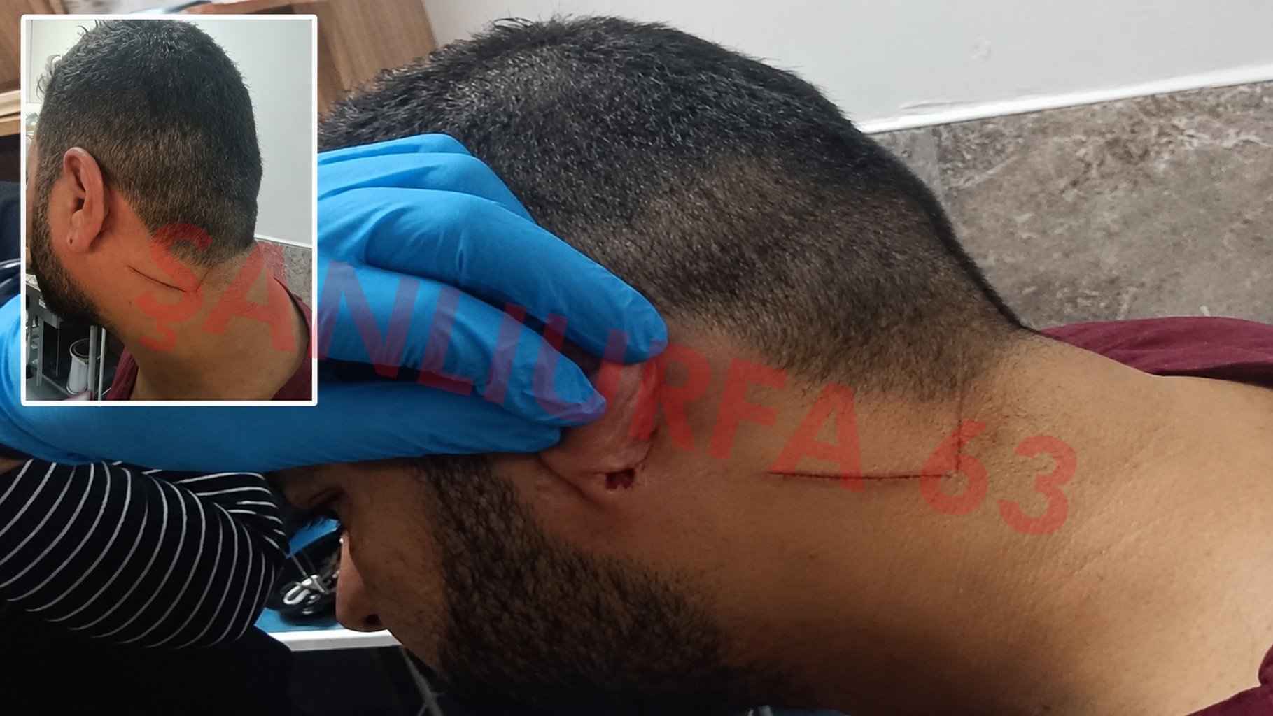 Şanlıurfa'da Hemşireyi Darbeden Şüpheli Adliyeye Sevk Edildi!