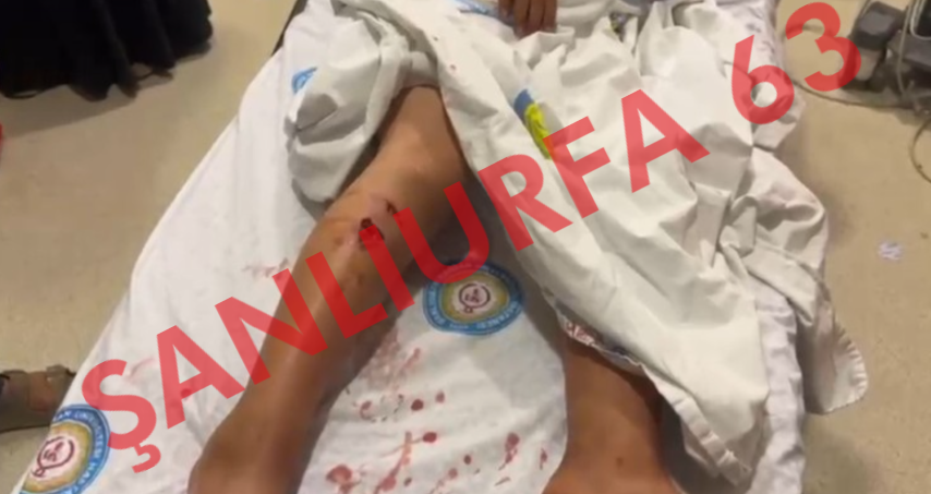 Şanlıurfa'da Korku Dolu Anlar! Küçük Çocuk Köpeklerin Hedefi Oldu